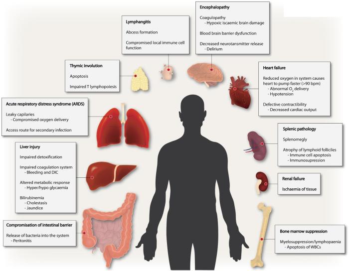 Which of the following statements about sepsis is false